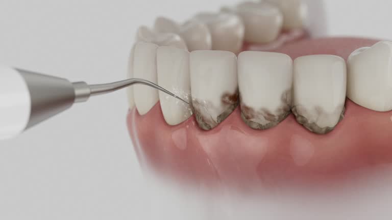 Reliable Dental contractor in Hampton, TN by Smile Center Dentistry